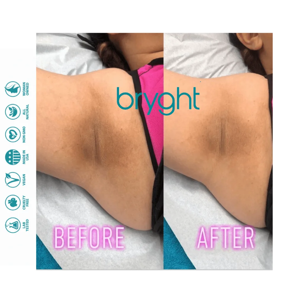 Bryghtenup Skin Brightening Work Showcase 12