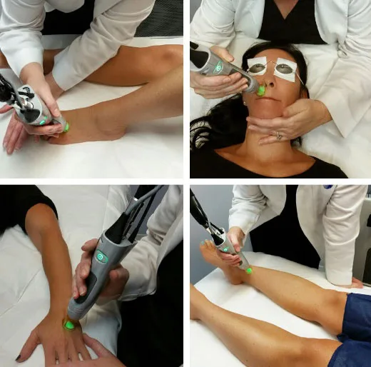 Laser Hair Removal Work Showcase 7