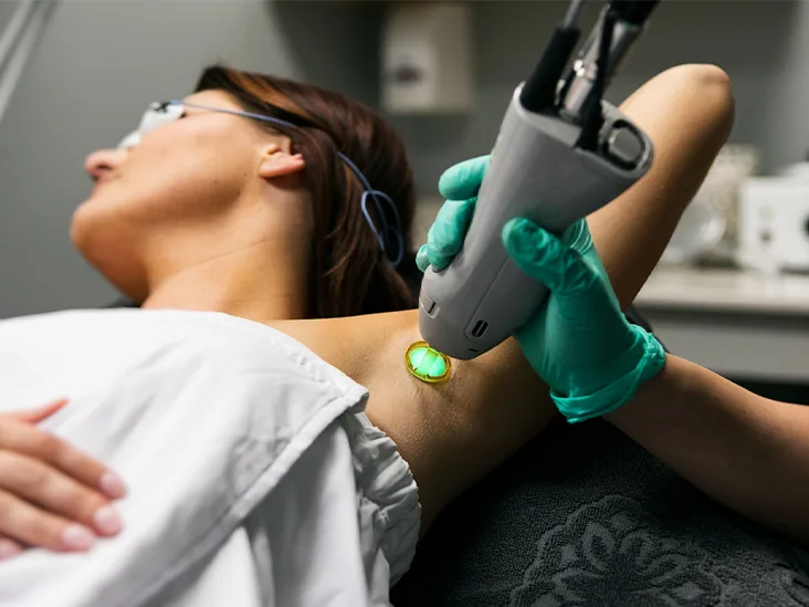 Laser Hair Removal Gallery 2